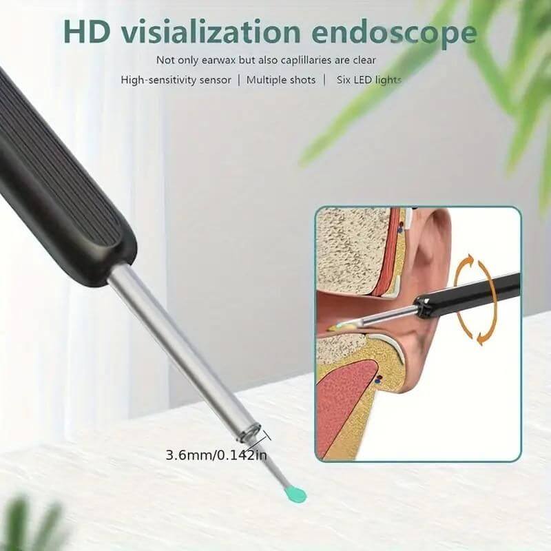 Ear Wax Removal Tool Kit | Smart Visual Ear Cleaner with 1296P WiFi Camera & LED | Digital Ear Scope Otoscope for iPhone, Android | Safe for Ear Inspection & Earwax Cleaning