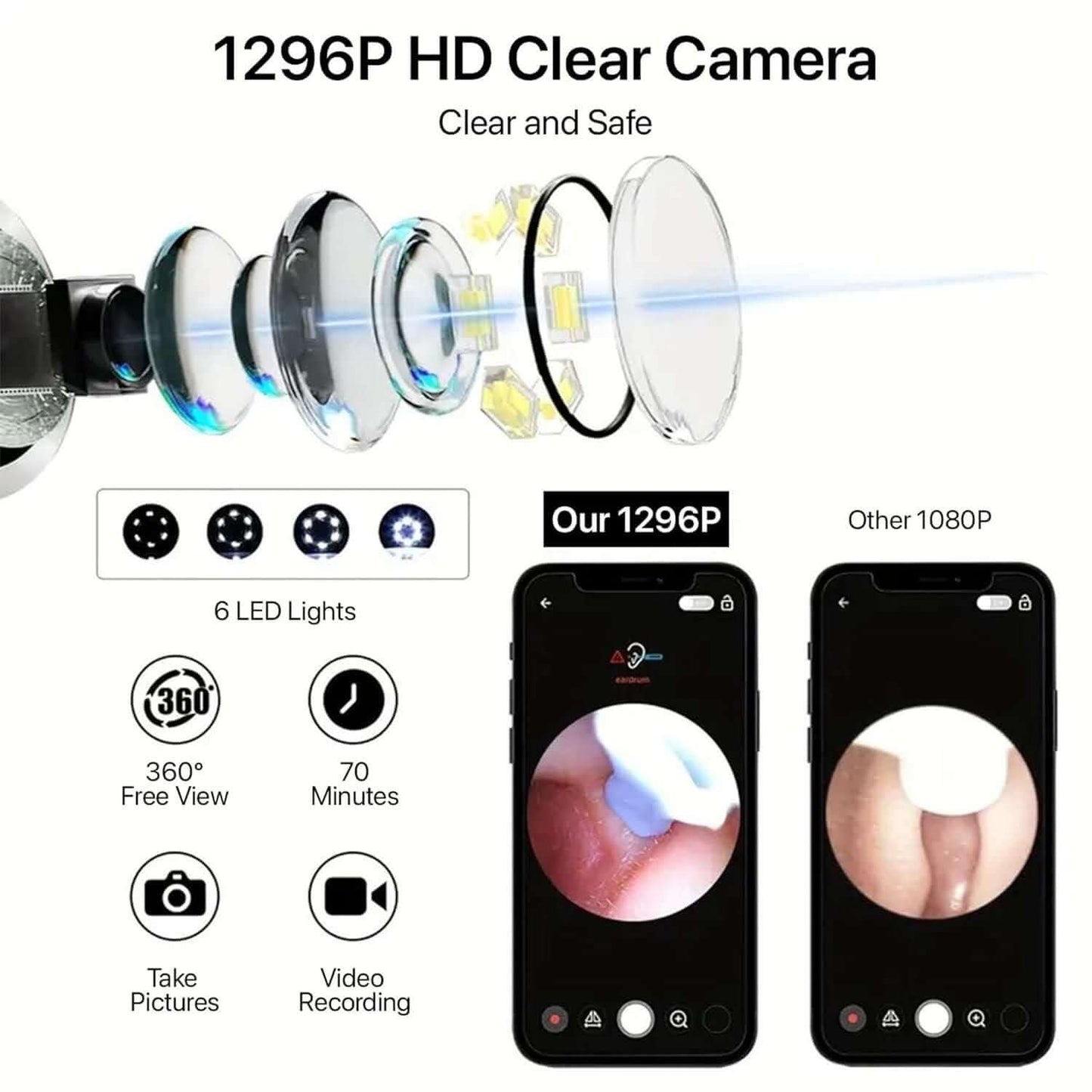Ear Wax Removal Tool Kit | Smart Visual Ear Cleaner with 1296P WiFi Camera & LED | Digital Ear Scope Otoscope for iPhone, Android | Safe for Ear Inspection & Earwax Cleaning