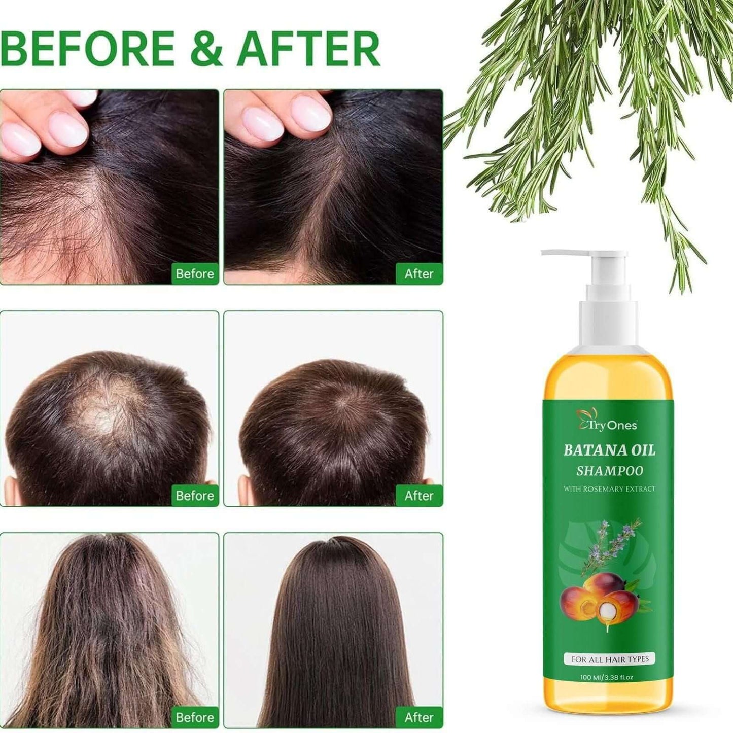 TryOnes Batana Oil Shampoo with Rosemary โ Hair Cleanser for All Hair Types | 100ml x 2 Bottles (Pack of 2)