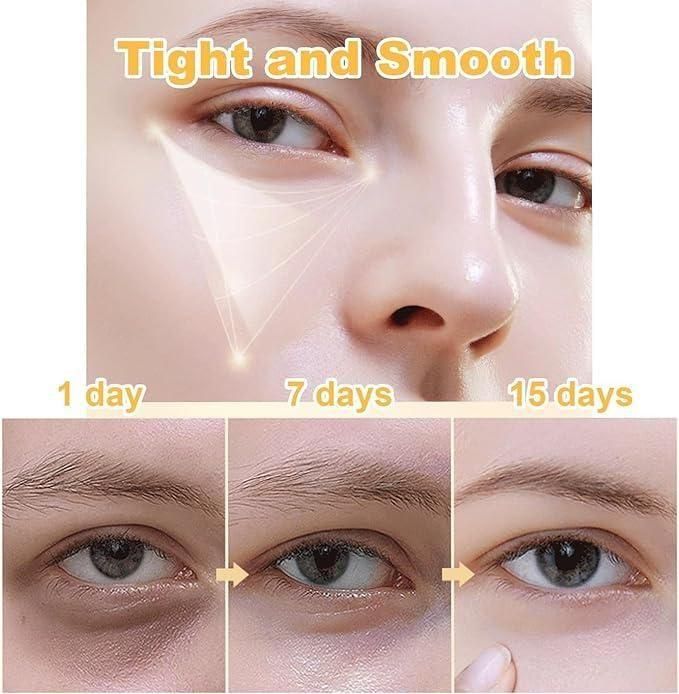 Instant FirmX Eye Bag Cream – Best Anti-Aging & Eye Firming Cream (50g) - UrbanAvi Store