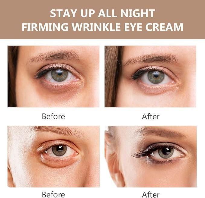 Instant FirmX Eye Bag Cream – Best Anti-Aging & Eye Firming Cream (50g) - UrbanAvi Store