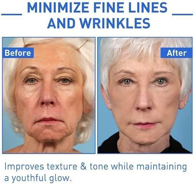 Botox Anti-Aging Face Serum – Youthful Skin Formula (Pack of 1) | Fine Line & Wrinkle Remover | 30ml - UrbanAvi Store